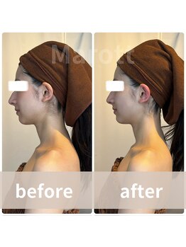 マロット 表参道店(Marott)/【20代女性】瞬間小顔リフト♪