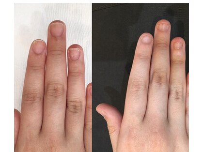 デアスパ(deaspa)の写真