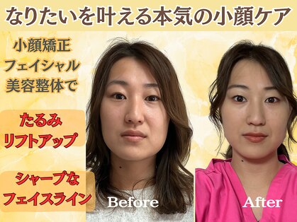 シルフィードの写真