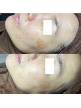 ホワラ 横浜店(Whila)/施術効果9