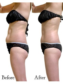 ロイヤルキューティー 介正鍼灸整骨院 コマーシャルモール博多(ROYAL QT)/こんなに変わる！