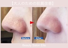エラ(Ella)