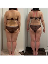 ラクシュミー/札幌　大通り　痩身　背中　凝り