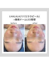 ポムハヌル(pom.haneul)/韓国肌管理室