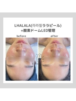 ポムハヌル(pom.haneul)/韓国肌管理室