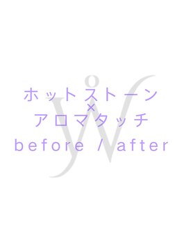 ウォーマル(warmaL)/