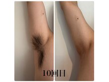 やどかりの雰囲気(効果絶大の最新LED脱毛で専門スタッフがお悩み解決致します♪)