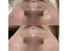 アトリーチェ(ATTRICE)の雰囲気(サロンケア×ホームケアの両方から美肌づくりをサポートします!)