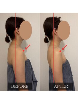 ツカ(TSUKA)/巻き肩、ストレートネックに！