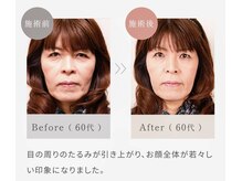 リアンシャンテ(Re enchanter)/