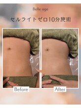 ベルアージュ(Belleage)/セルゼロ