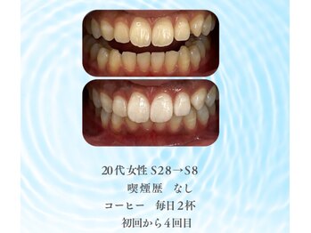 ハルロス(harlos)/驚きの変化！