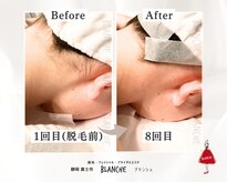 ブランシュ(BLANCHE)