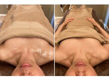 ミモザ/バストケアにもなります♪