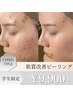 【学割U24】肌質改善☆剥離なしピーリング7種