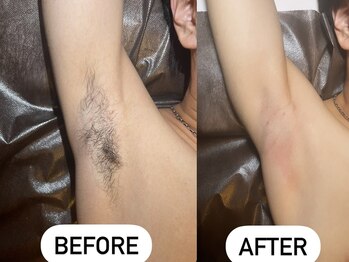 ソーレエルーナ(SOLE e LUNA)/Tシャツから見える残念ポイント