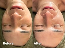 シゼン 恵比寿店(S1ZEN+)/ハーブトリートメント1回