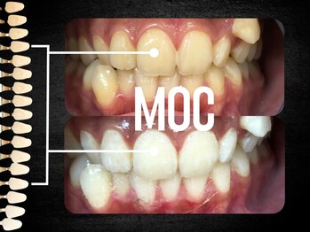 モック 麻布十番(MOC)/ホワイトニング/麻布十番/六本木