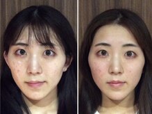 美容整体ウェリナ 名駅院/小顔矯正/骨盤矯正/美脚サロン