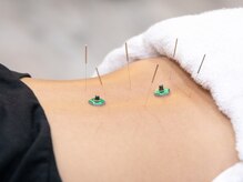 シャイン鍼灸整骨院 粉浜院