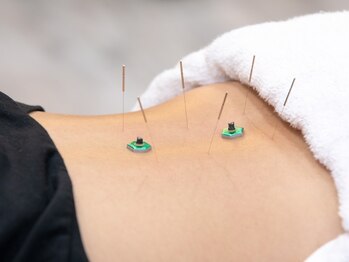 シャイン鍼灸整骨院　粉浜院の写真/【全身整体×鍼灸】首肩・腰のつらさに！国家資格者の施術で根本から改善へ