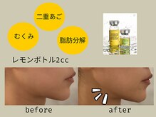 プレリー 自由が丘店/レモンボトル＆ラジオ派