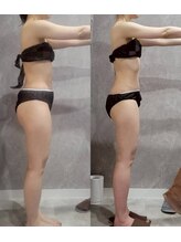 ユニ(uni.)/痩身症例