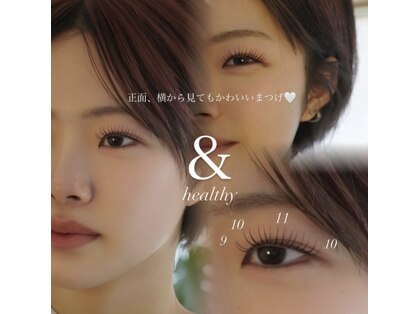 ステイゴールド(STAY GOLD)の写真