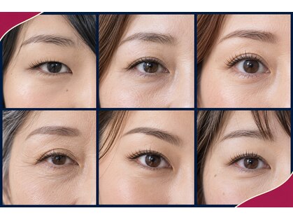 ラズベリー ベレー(Raspberry Beret)の写真