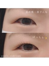 スープル アイ(SOUPLE.eye)/瞼に当たらないように♪