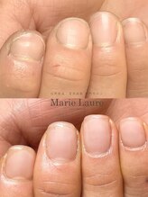 マリーロール 梅田店(Marie Laure)/自爪育成/深爪矯正/ネイルケア