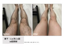 ハナフク(hanafuku)/before→after