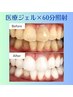 【1回4500円・回数券】業界最長60分照射×歯科提携ジェルで圧倒的な白さ◎