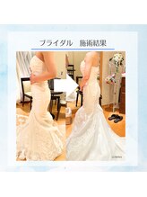 ルミナ ビューティーアンドリラックス(LUMINA Beauty&Relax)/挙式までに二の腕ボディメイク☆