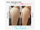 サロン ド リボーン(Salon de RE-BORN)の写真
