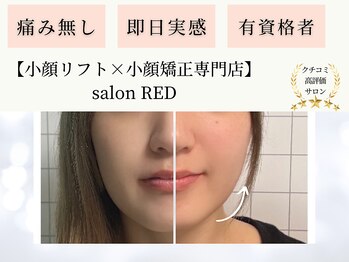 レッド(RED)