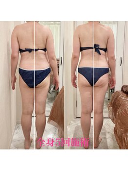 えすてさろん ケイアンドエフ(k&f)/肩こり・腰痛・膝痛に効果的