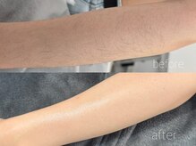 ハリウッドブロウリフト ワクシー 新宿店(HOLLYWOOD BROW LIFT WAXYYY.)/ワックス脱毛