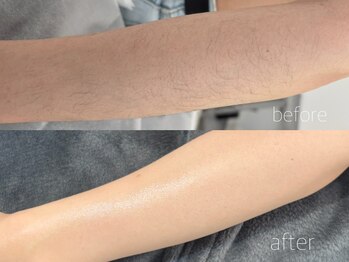 ハリウッドブロウリフト ワクシー 新宿店(HOLLYWOOD BROW LIFT WAXYYY.)/ワックス脱毛