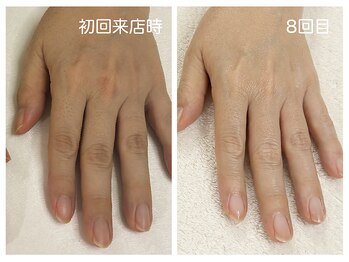 キレイテ 上野店/40代/8回目【ハンドケア上野】