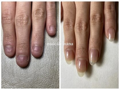 ネイルカフェ ナナ(nailcafe'nana)の写真