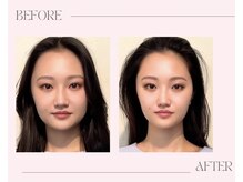 美骨鍼灸整骨院/美容整体マッサージ