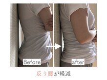 整体あゆむ 立川店/before after３