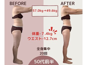 エテルナ(Eterna)/安城市 &nbsp;ダイエット　痩身