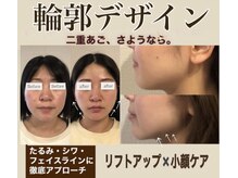 エム(M)