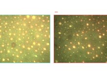 ベベ もりの里店(Be'be')/毛穴汚れの改善例