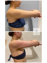 マシェリ 吉祥寺(Macherie)/脂肪燃焼　10ml導入