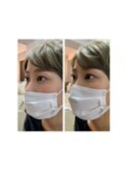 カウズ 甲東園(CAWS)/アップワードリフトJカール