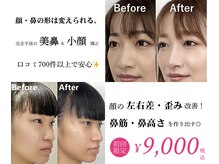 ラプリボーテ(Raplit BEAUTE)