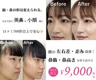 ラプリボーテ(Raplit BEAUTE)